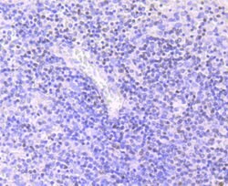 Invitrogen MEF2A Recombinant Rabbit Monoclonal Antibody (JA33-04) 100 &mu;L;