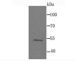 Invitrogen MEF2A Recombinant Rabbit Monoclonal Antibody (JA33-04) 100 &mu;L;