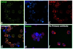 ULK1 Recombinant Rabbit Monoclonal Antibody (JA58-36), Invitrogen 100 &mu;L;