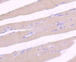 ULK1 Recombinant Rabbit Monoclonal Antibody (JA58-36), Invitrogen 100 &mu;L;