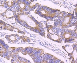 ULK1 Recombinant Rabbit Monoclonal Antibody (JA58-36), Invitrogen 100 &mu;L;