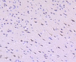 ULK1 Recombinant Rabbit Monoclonal Antibody (JA58-36), Invitrogen 100 &mu;L;