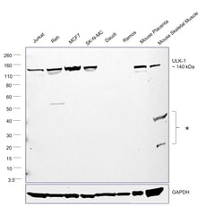 ULK1 Recombinant Rabbit Monoclonal Antibody (JA58-36), Invitrogen 100 &mu;L;