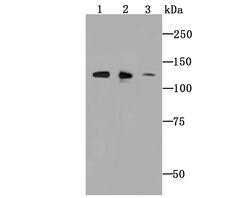 ULK1 Recombinant Rabbit Monoclonal Antibody (JA58-36), Invitrogen 100 &mu;L;
