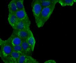 Invitrogen GOLPH2 Recombinant Rabbit Monoclonal Antibody (JA63-03) 100 &mu;L | Buy Online | Invitrogen&trade; | Fisher Scientific