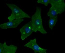 Invitrogen GOLPH2 Recombinant Rabbit Monoclonal Antibody (JA63-03) 100 &mu;L | Buy Online | Invitrogen&trade; | Fisher Scientific