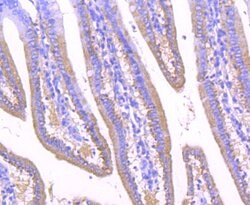 Invitrogen GOLPH2 Recombinant Rabbit Monoclonal Antibody (JA63-03) 100 &mu;L | Buy Online | Invitrogen&trade; | Fisher Scientific
