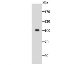 Invitrogen GOLPH2 Recombinant Rabbit Monoclonal Antibody (JA63-03) 100 &mu;L | Buy Online | Invitrogen&trade; | Fisher Scientific