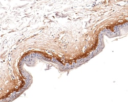 Invitrogen Periostin Recombinant Rabbit Monoclonal Antibody (JA63-40) 100