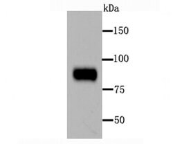 Invitrogen Periostin Recombinant Rabbit Monoclonal Antibody (JA63-40) 100