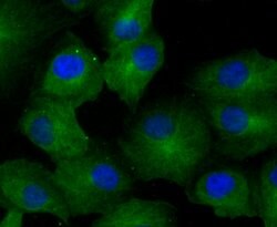 Invitrogen GCN2 Recombinant Rabbit Monoclonal Antibody (JA03-83) 100 &mu;L;