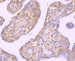 Invitrogen GCN2 Recombinant Rabbit Monoclonal Antibody (JA03-83) 100 &mu;L;