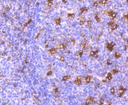 Invitrogen MMP9 Recombinant Rabbit Monoclonal Antibody (JA80-73) 100 &mu;L;