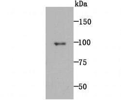 Invitrogen MMP9 Recombinant Rabbit Monoclonal Antibody (JA80-73) 100 &mu;L;
