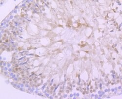 Invitrogen DAZL Recombinant Rabbit Monoclonal Antibody (JA10-36) 100 &mu;L;