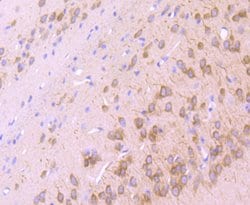 Invitrogen IP3 Receptor 1 Recombinant Rabbit Monoclonal Antibody (JA11-35)