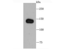 Invitrogen Complement Factor H Recombinant Rabbit Monoclonal Antibody (JA52-13) 100 &mu;L | Buy Online | Invitrogen&trade; | Fisher Scientific