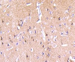 Invitrogen PKC epsilon Recombinant Rabbit Monoclonal Antibody (JA38-21)