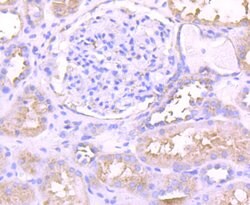 Invitrogen PKC epsilon Recombinant Rabbit Monoclonal Antibody (JA38-21)
