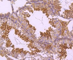 Invitrogen PKC epsilon Recombinant Rabbit Monoclonal Antibody (JA38-21)