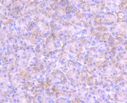 Invitrogen PKC epsilon Recombinant Rabbit Monoclonal Antibody (JA38-21)