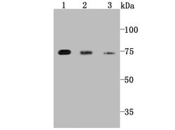 Invitrogen PKC epsilon Recombinant Rabbit Monoclonal Antibody (JA38-21)