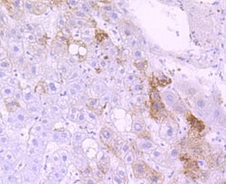 Invitrogen CYP3A4 Recombinant Rabbit Monoclonal Antibody (JA11-33) 100