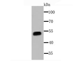 Invitrogen CYP3A4 Recombinant Rabbit Monoclonal Antibody (JA11-33) 100
