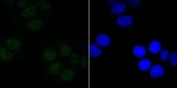 Invitrogen SIN3A Recombinant Rabbit Monoclonal Antibody (JA94-31) 100 &mu;L;
