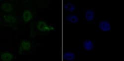 Invitrogen SIN3A Recombinant Rabbit Monoclonal Antibody (JA94-31) 100 &mu;L;