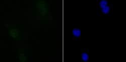 Invitrogen SIN3A Recombinant Rabbit Monoclonal Antibody (JA94-31) 100 &mu;L;