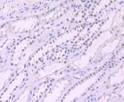 Invitrogen SIN3A Recombinant Rabbit Monoclonal Antibody (JA94-31) 100 &mu;L;