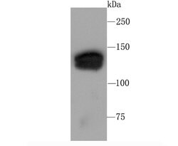 Invitrogen SIN3A Recombinant Rabbit Monoclonal Antibody (JA94-31) 100 &mu;L;