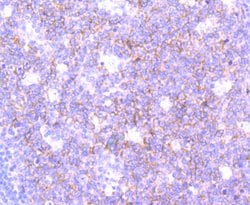 Invitrogen SNAP23 Recombinant Rabbit Monoclonal Antibody (JA73-15) 100