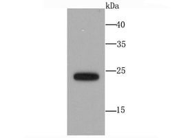 Invitrogen SNAP23 Recombinant Rabbit Monoclonal Antibody (JA73-15) 100
