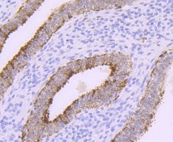 Invitrogen POLB Recombinant Rabbit Monoclonal Antibody (JM93-12) 100 &mu;L | Buy Online | Invitrogen&trade; | Fisher Scientific