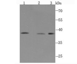 Invitrogen POLB Recombinant Rabbit Monoclonal Antibody (JM93-12) 100 &mu;L | Buy Online | Invitrogen&trade; | Fisher Scientific