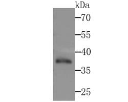 Invitrogen POLB Recombinant Rabbit Monoclonal Antibody (JM93-12) 100 &mu;L | Buy Online | Invitrogen&trade; | Fisher Scientific
