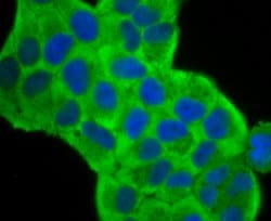 Invitrogen Fascin Recombinant Rabbit Monoclonal Antibody (JM12-53) 100