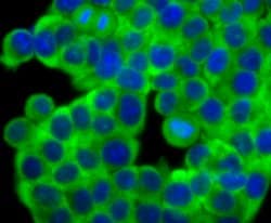 Invitrogen Fascin Recombinant Rabbit Monoclonal Antibody (JM12-53) 100