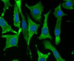 Invitrogen Fascin Recombinant Rabbit Monoclonal Antibody (JM12-53) 100