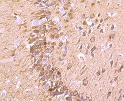 Invitrogen Fascin Recombinant Rabbit Monoclonal Antibody (JM12-53) 100