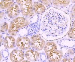 Invitrogen Fascin Recombinant Rabbit Monoclonal Antibody (JM12-53) 100