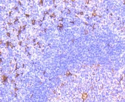 Invitrogen Fascin Recombinant Rabbit Monoclonal Antibody (JM12-53) 100