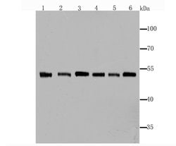 Invitrogen Fascin Recombinant Rabbit Monoclonal Antibody (JM12-53) 100
