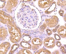 Invitrogen Dynamin 2 Recombinant Rabbit Monoclonal Antibody (JM61-38) 100
