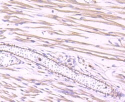 Invitrogen Dynamin 2 Recombinant Rabbit Monoclonal Antibody (JM61-38) 100