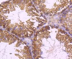 Invitrogen Dynamin 2 Recombinant Rabbit Monoclonal Antibody (JM61-38) 100
