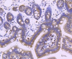 Invitrogen Dynamin 2 Recombinant Rabbit Monoclonal Antibody (JM61-38) 100
