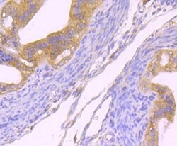 Invitrogen Dynamin 2 Recombinant Rabbit Monoclonal Antibody (JM61-38) 100